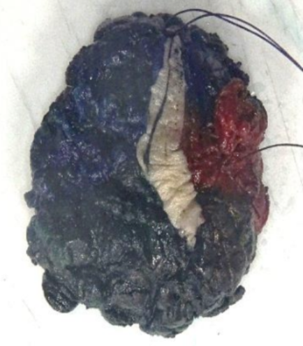 Description of the image